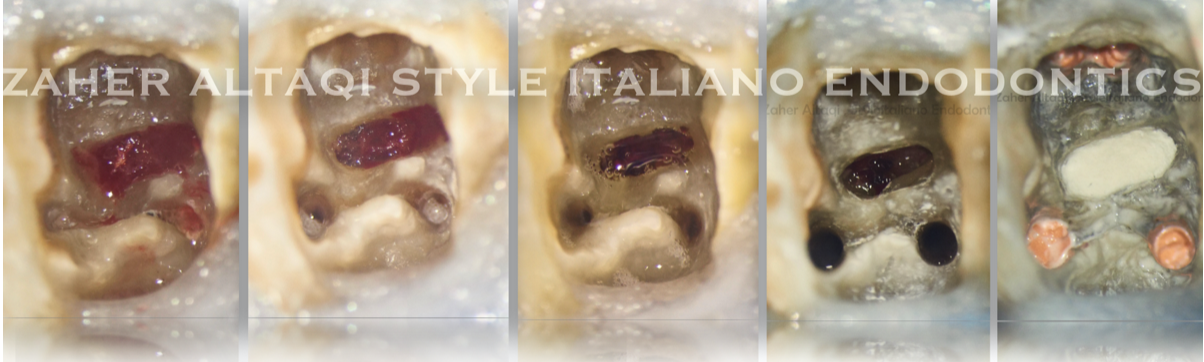 Perforation blade diecut | DAISO | G-Tape creasing matrix Perforation blade diecut | DAISO | G-Tape creasing matrix